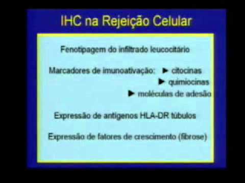 HCPA - Grand Round - Rejeição de Transplantes: Ainda um Problema Relevante - Novas Abordagens