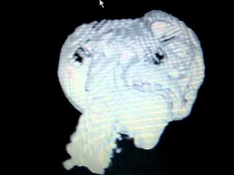 VTK Human Head Visualization 4