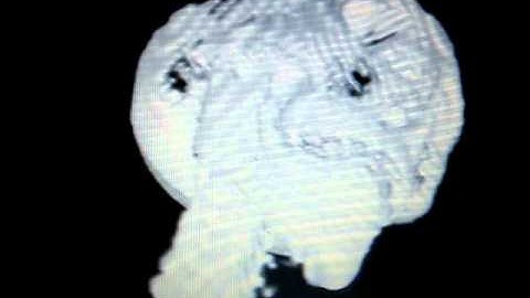 VTK Human Head Visualization 4