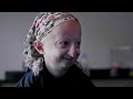 Living With Progeria | BORN DIFFERENT