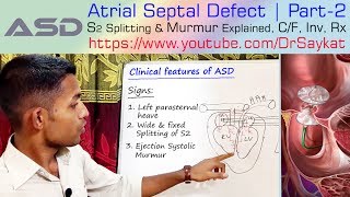 Atrial Septal Defect (ASD) | Part 2 | S2 Splitting & Murmur Explained | Dr. Saykat
