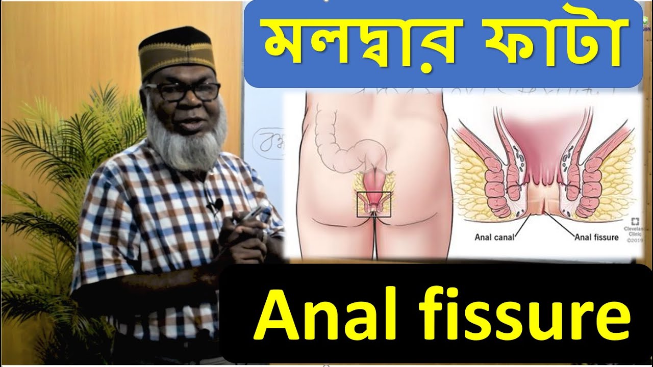 Jinsiy oyinlarda homiy ayol