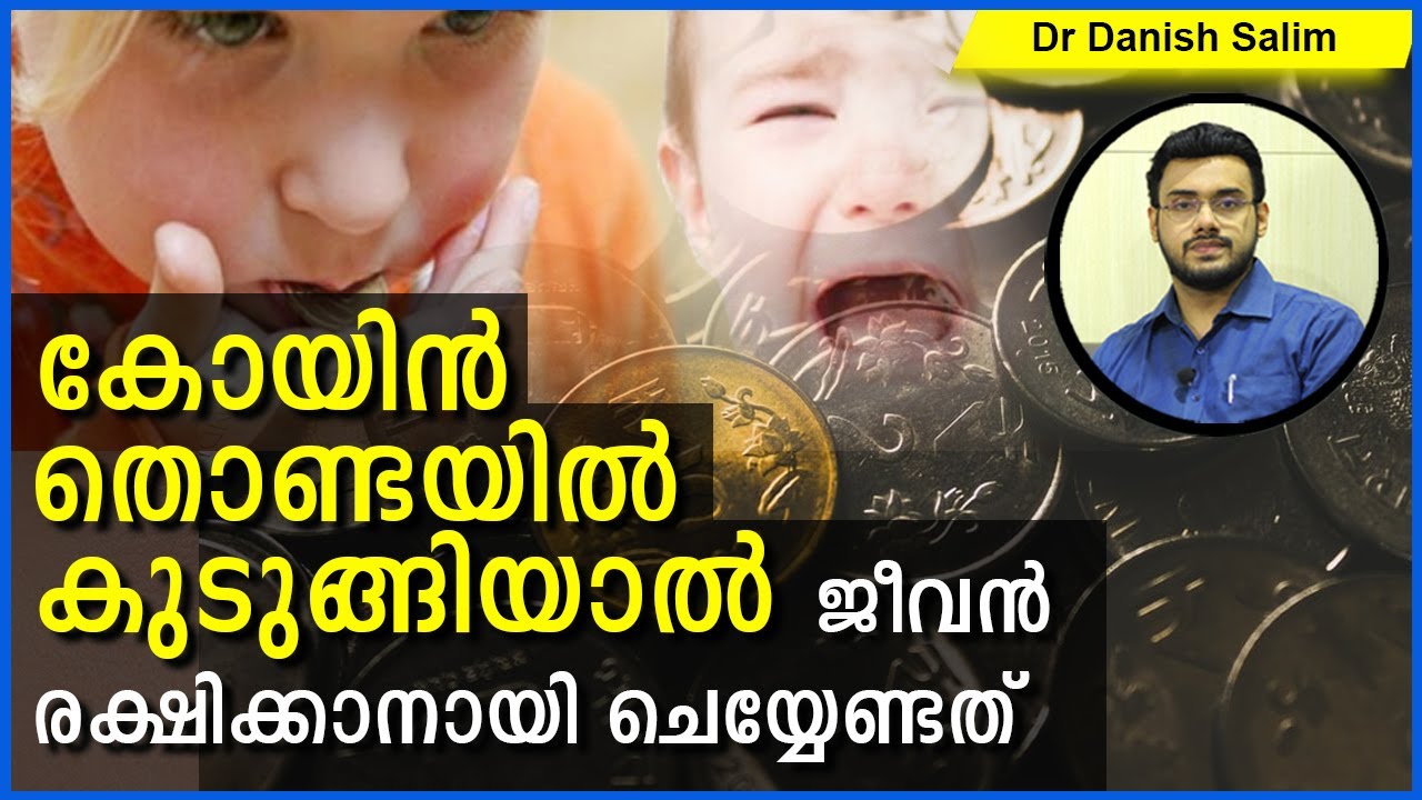 562: കുട്ടിയുടെ തൊണ്ടയിൽ കോയ്‌നോ (Coin) ചെറിയ കളിപ്പാട്ടങ്ങളോ കുടുങ്ങിയാൽ എന്താണ് ചെയ്യേണ്ടത്?