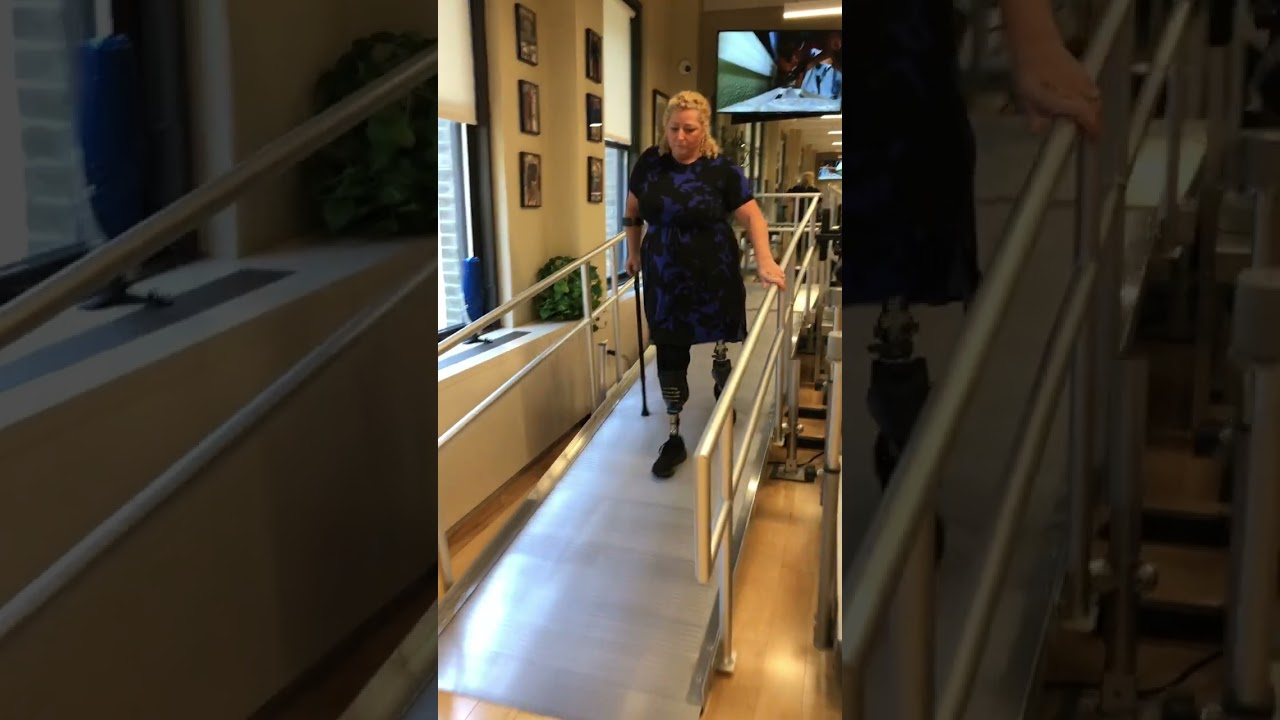 Laura's bilateral prostheses