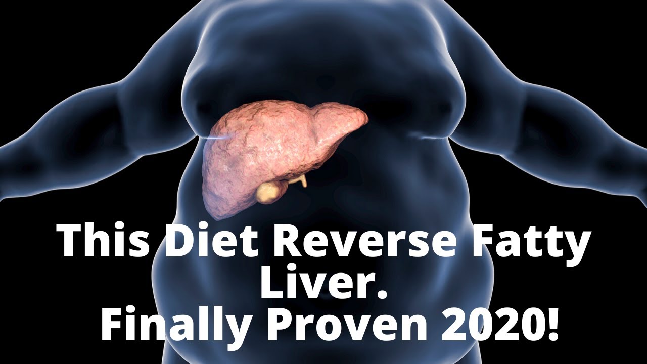 How To Reverse Fatty Liver Finally Proven in 2020 YouTube