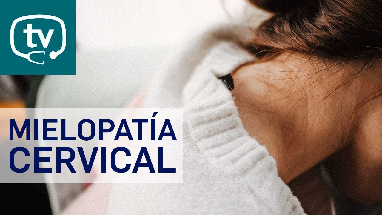 Mielopatía cervical por espondilosis cervical - YouTube