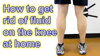 How to get rid of Fluid on The Knee at Home
