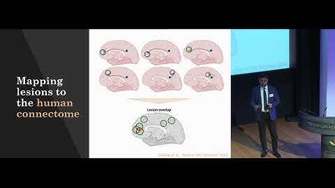 Circuit-based Neuromodulation across symptoms and disorders - Shan Siddiqi