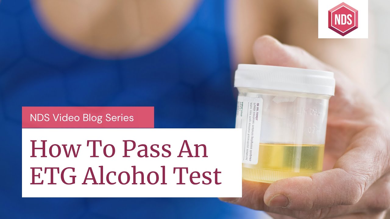 How To Pass An Etg Urine Or Hair Alcohol Test [Pass Your Etg Test]