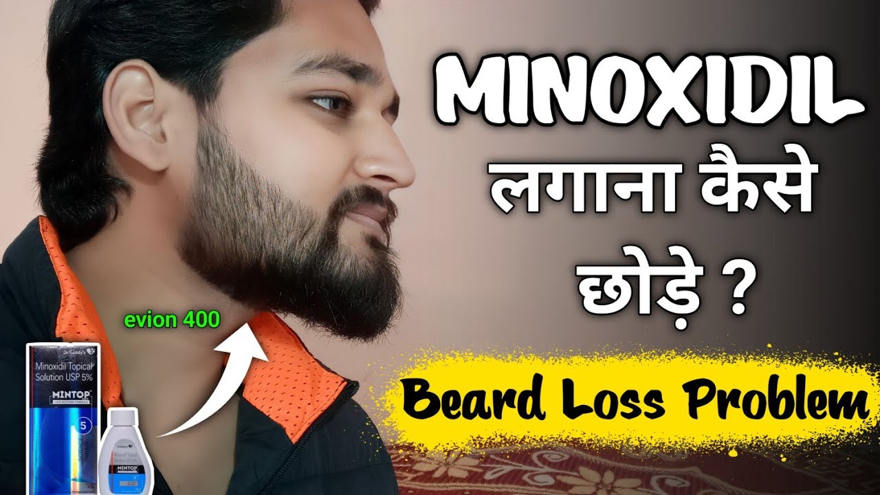 How to stop using minoxidil | Beard loss problem | I use evion 400 ...