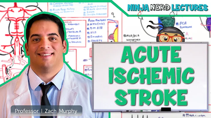 Acute Ischemic Stroke: Etiology, Pathophysiology, Clinical Features, Diagnostics, Treatment - DayDayNews