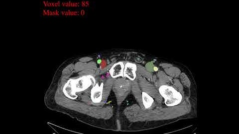 Complete vasculature of the pelvis