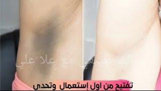 سواد20سنه ساينتهي العنق والعانه تبيض المناطق الحساسه بمسحه واحده فقط تبيض الجسم من اول استعمال مجربة