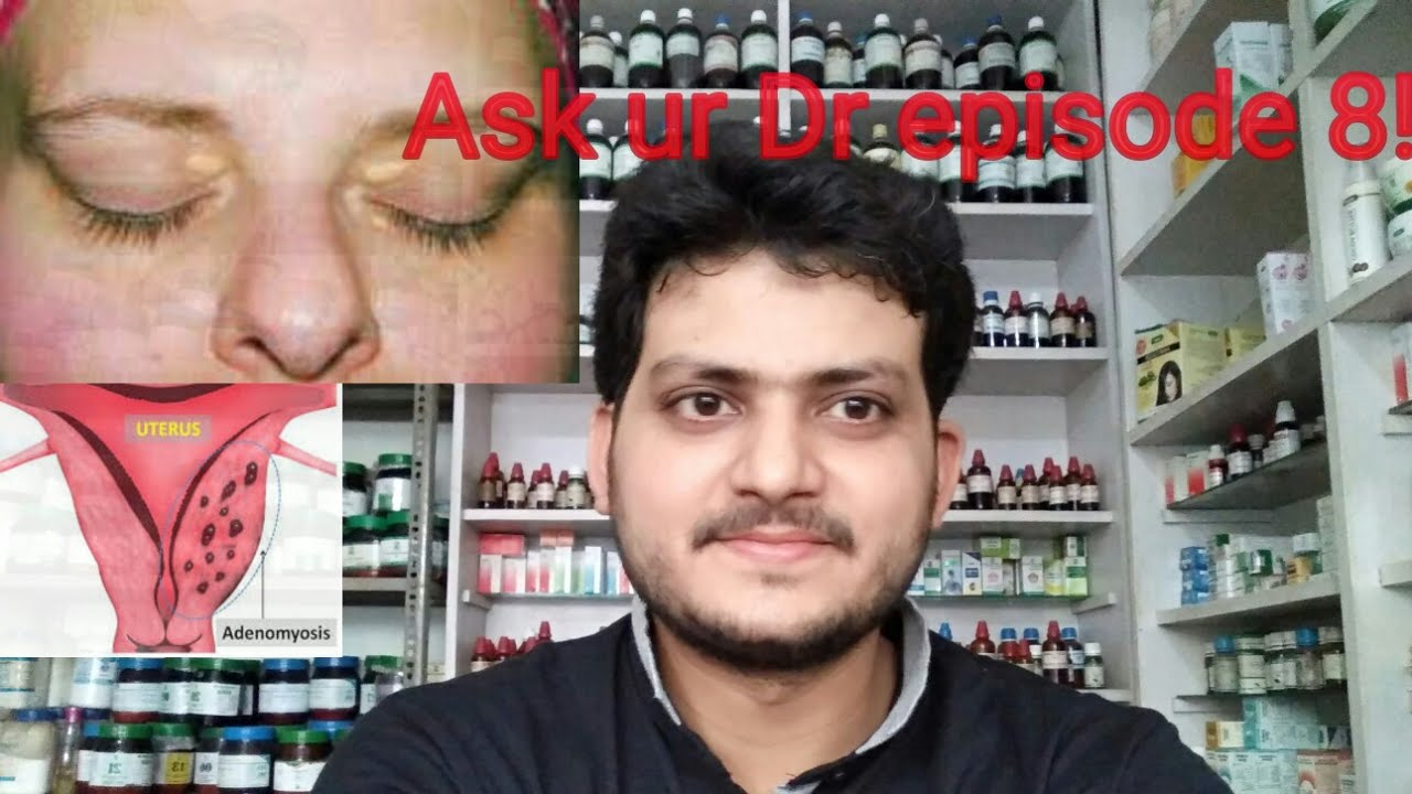 Ask Ur Dr Episode 8 Xanthelasma Adenomyosis Youtube