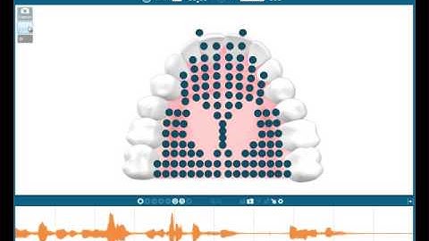Generalizing Articulation Therapy