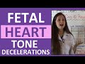Fetal Heart Rate Decelerations in Maternity 🩺