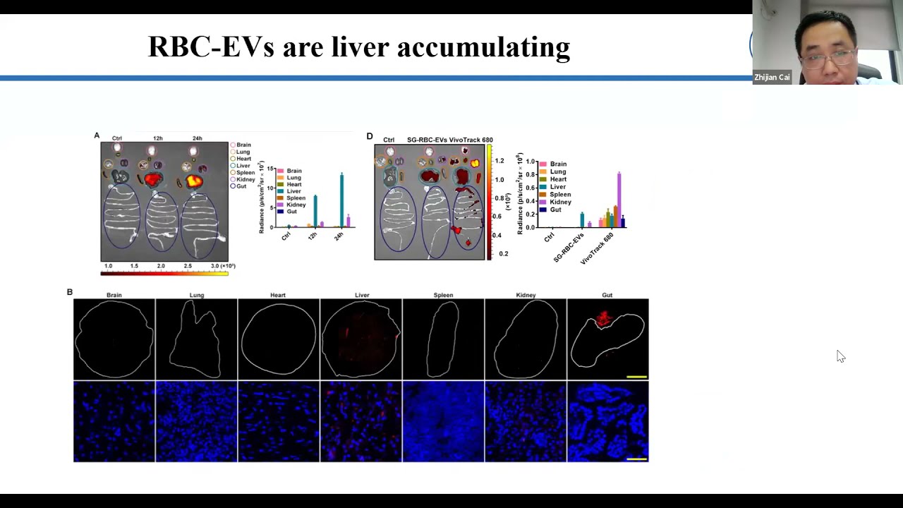 EVs: Natural liver-accumulating drug delivery vehicles for liver diseases by Zhijian Cai