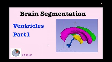 🧠Brain Segmentation with 3D Slicer: Ventricles (Part1)