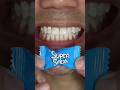 "Super Sour" Nobel Super Soda Candy ASMR #shorts #asmr