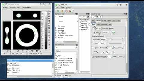 AMILab LevelSet Segmentation