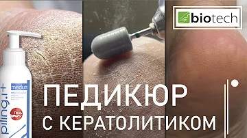 АППАРАТНЫЙ ПЕДИКЮР С КЕРАТОЛИТИКОМ.