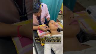 Advanced Dry Needling Therapy Best Physiotherapy Rehabilitation Unit in Kolkata 