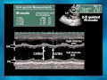 Principles of Echocardiography part I    Dr  Khaled Refaat In Arabic