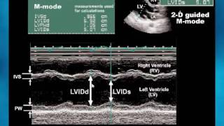 Principles of Echocardiography part I    Dr  Khaled Refaat In Arabic