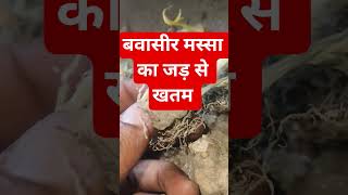 Fistula Treatment #shortvideo #tranding #viralvideo