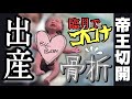 【出産レポ】はじめてのお産が高難易度すぎた!!!【臨月~入院&帝王切開】