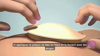 Application d'une poche de stomie 1 pièce Application d'une poche de stomie 1 pièce