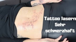 4 Tattoos Entfernen Lassen Tattoo Lasern Mein Bauch Wird Gemacht Youtube