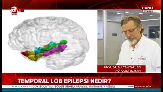 Temporal Lob Epilepsi nasıl bir hastalıktır?