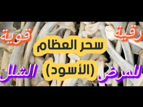 من أقوى الرقيات لنسف وابطال السحر الأسود صنع للمرض والشلل سحر العظام ولا يفلح الساحر حيث أتى من أقوى الرقيات لنسف وابطال السحر الأسود صنع للمرض والشلل سحر العظام ولا يفلح الساحر حيث أتى