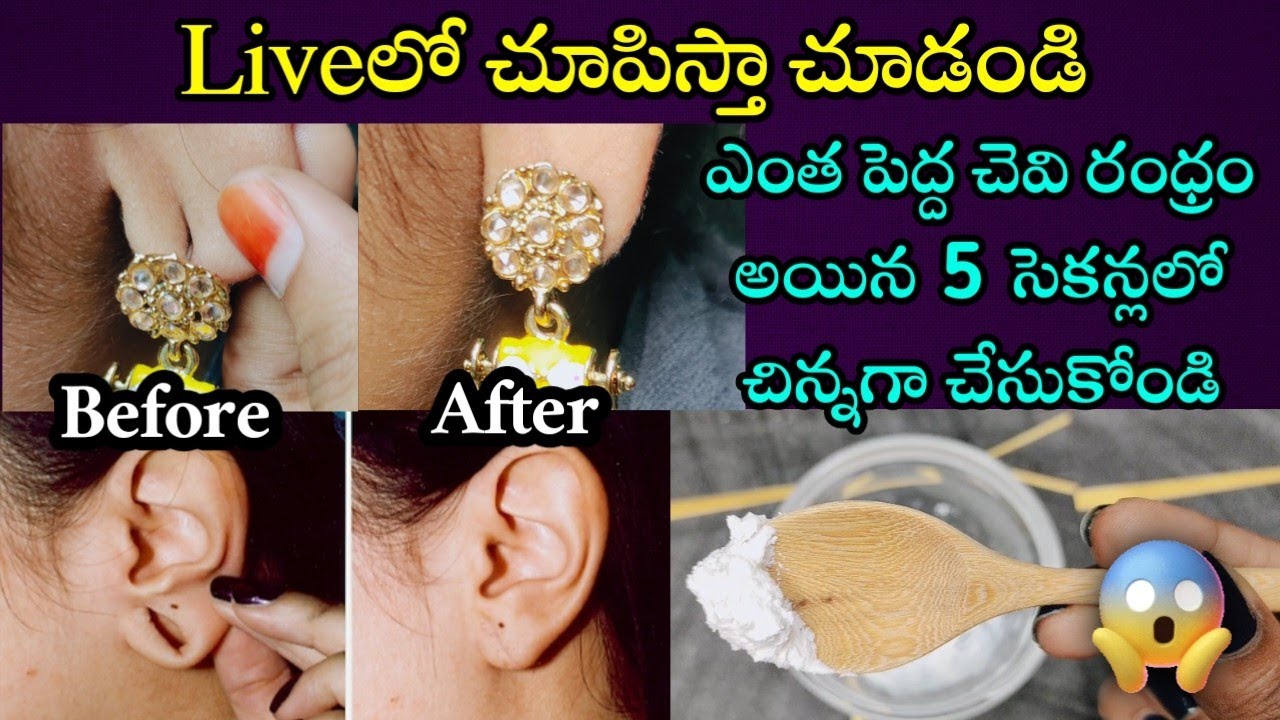 🔥ఎంత సాగిపోయిన చెవి రంధ్రమైన 5 సెకన్లలో చిన్నగా మార్చుకోండి | How to Shrink Earholes at home | Geeta