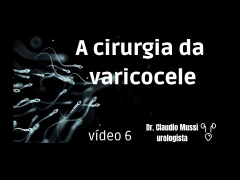 Varicocele surgery