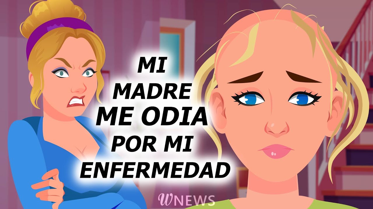 Durante un desfile de moda se me cayó la peluca, dejando al descubierto mi calva