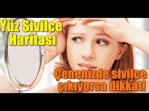 Video: Çenedeki Sivilceler Sindirim Sorunlarının Bir Işaretidir