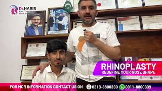 Rhinoplasty Before and After Surgery || Reshape Your Nose || Dr. Habib Hair Transplant Clinic