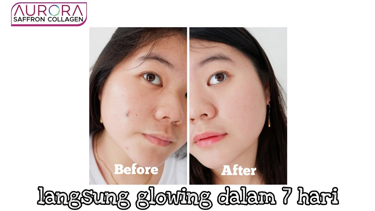 MINUMAN COLLAGEN BER-SAFFRON ini bikin kulit jadi GLOWING ? ( AURORA SAFFRON COLLAGEN )