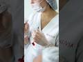 Контурная пластика губ💉