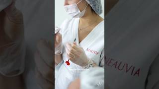 Контурная пластика губ💉
