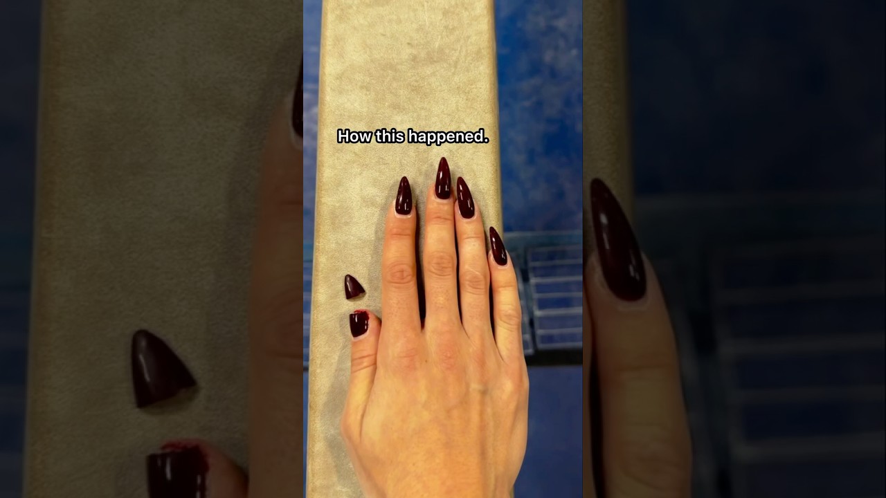 Я СЛОМАЛ НОГТЬ, занимаясь гимнастикой 😭