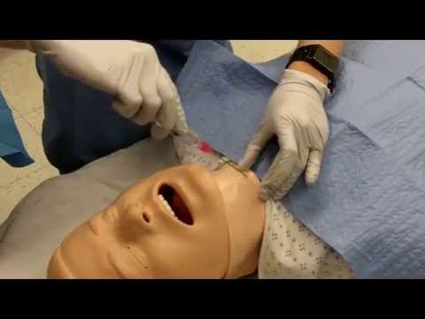 Video Otolaryngology-Head and Neck Surgery. tracheostomy... - youtube