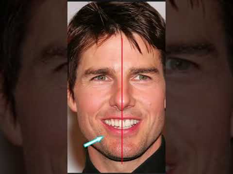 توم كروز ومشاكل اسنانه اسنان صحة صحتك بالدنيا توم توماس شيلبي توم كروز تجميل  