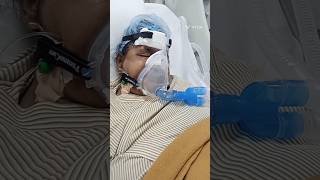 Bipap Mode Ventilator