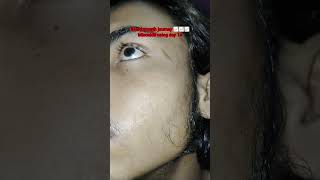 man matters minoxidil using day 14 #viralshort #beardgrowth #minoxidil #keepsupporting