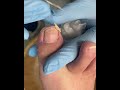 Satisfying Pedicure Routine | Gentle Toenail Care #fypシ #fypシ #pedicure #nailcare