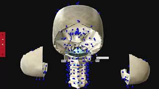 VIVED - Netter 3D Anatomy