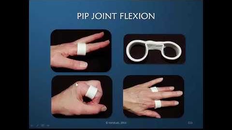 Obstinate PIP Joint: Part 11 of 12:  Active Redirection for PIP Joint Flexion (Demonstration)